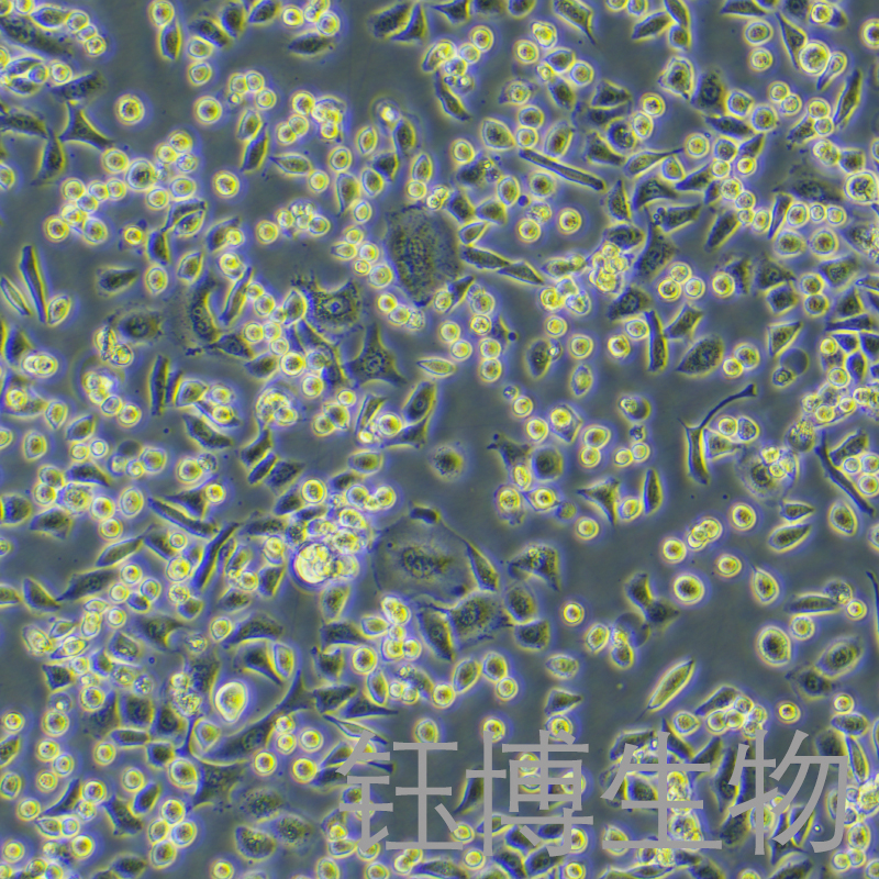 NCI-H1355（人非小细胞肺癌细胞）YB-75827HC