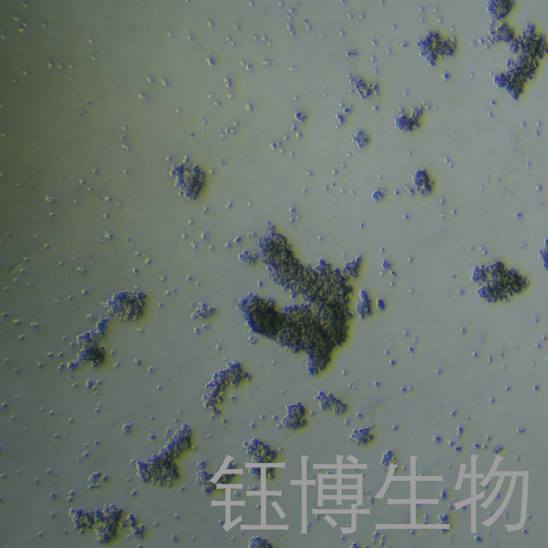 NCI-H1836（小细胞肺癌细胞）YB-75834HC