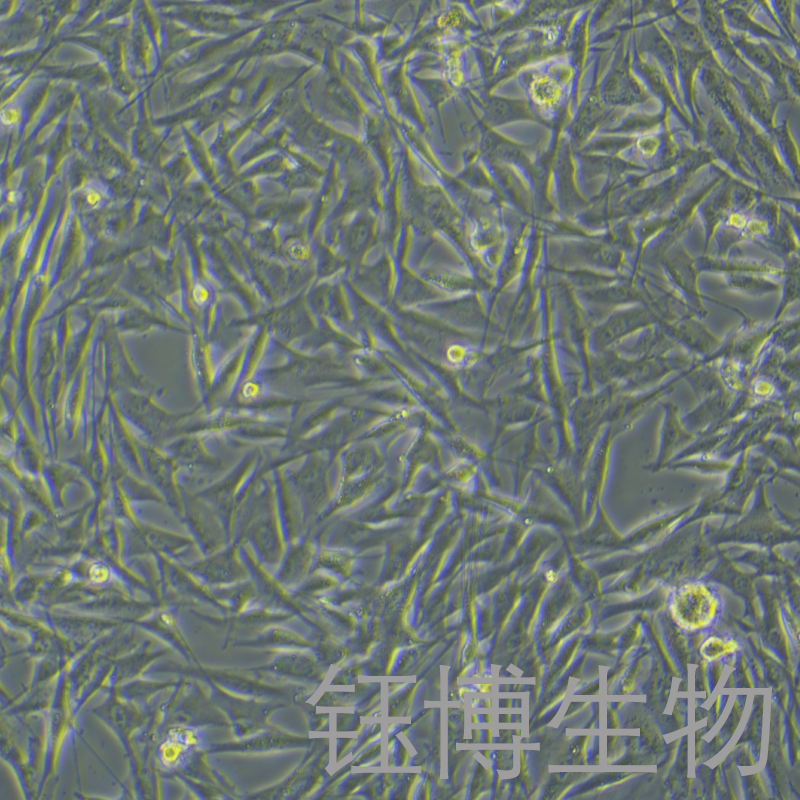 NCI-H1975-LUC-GFP-Puro（人肺腺癌细胞-绿色荧光蛋白-荧光素酶标记）YB-71298HC-LGP