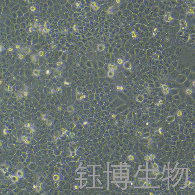 NCM460（人正常结肠上皮细胞系）YB-75839HC