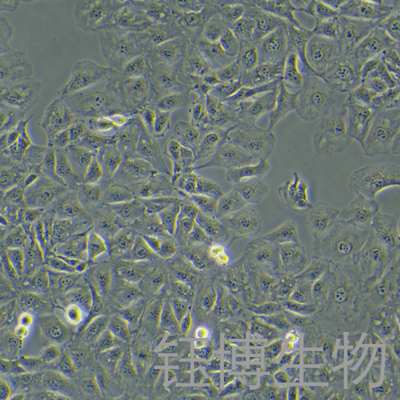 OAW42（卵巢癌细胞）YB-75842HC