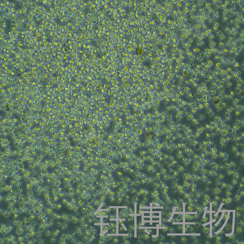 OCI-LY10（人弥漫大B淋巴瘤细胞）YB-75843HC