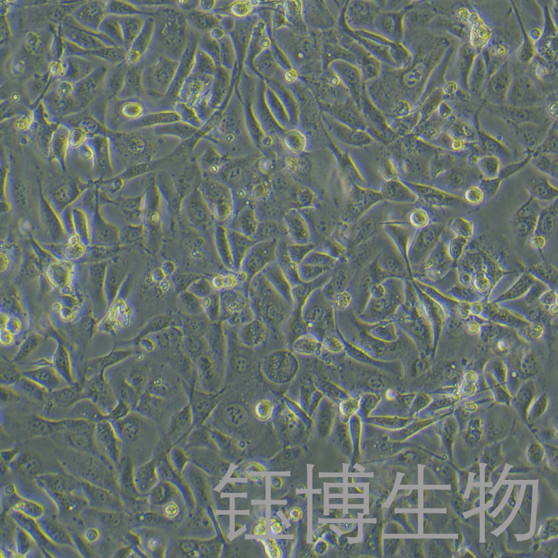 OV56（浆液性卵巢腺癌细胞）YB-75848HC