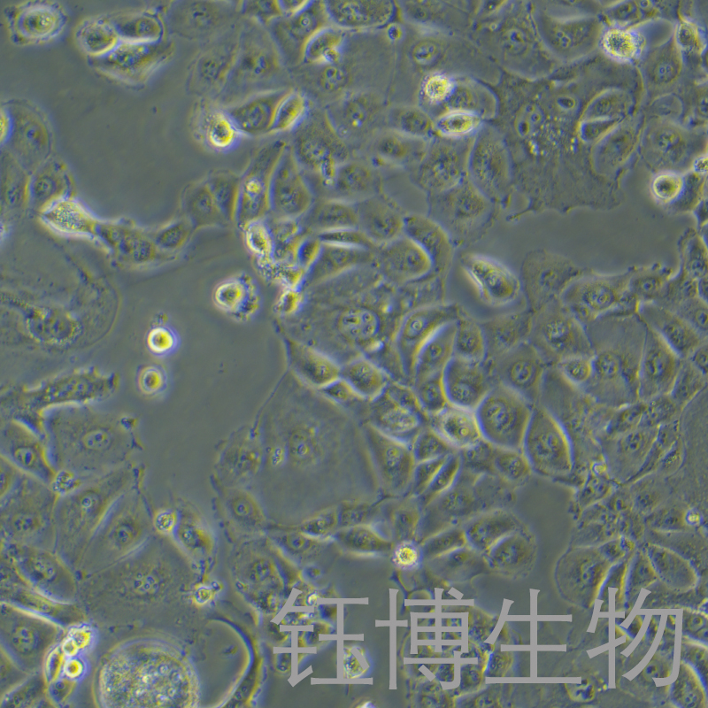 OVISE（人卵巢癌细胞）YB-75849HC