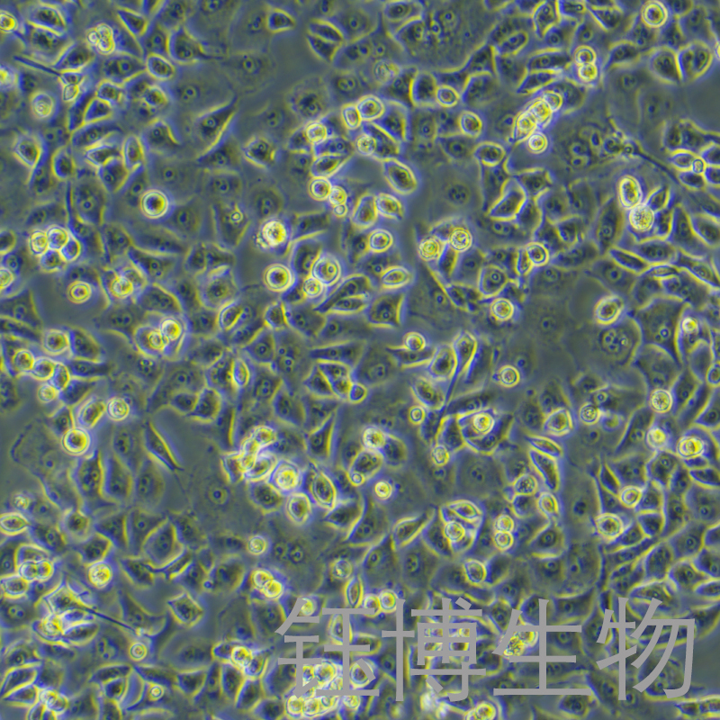 PANC-1-LUC-eGFP-Puro（人胰腺癌细胞-绿色荧光蛋白-荧光素酶标记）YB-71184HC-LGP