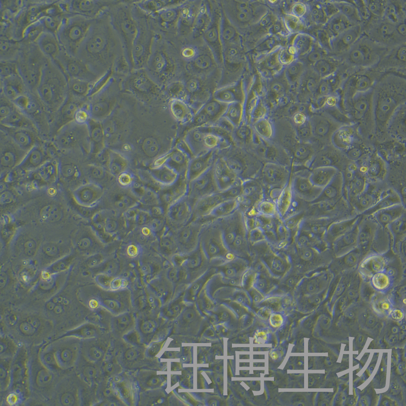 PANC-1/GEM/（人胰腺癌细胞吉西他滨耐药株）YB-71184HCR