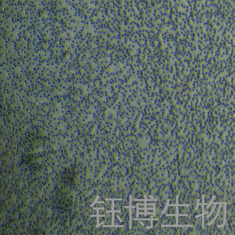 PBMC（人原代外周血单个核细胞）YB-75854HC