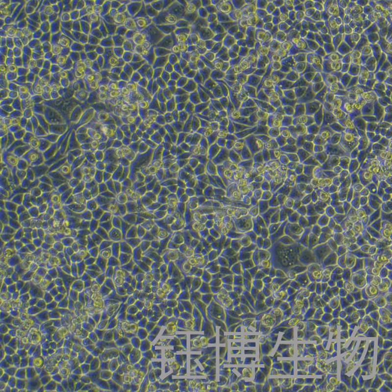 PC-9-LUC（人肺腺癌细胞带荧光素酶）YB-71668HC-L