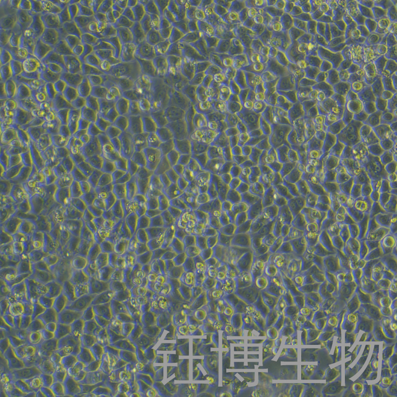 PC-9-LUC-GFP（人肺腺癌细胞带荧光素酶）YB-71668HC-LG