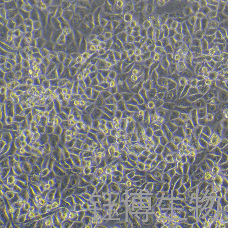 PC-9/GR（人肺癌细胞吉非替尼耐药株）YB-71668HCR