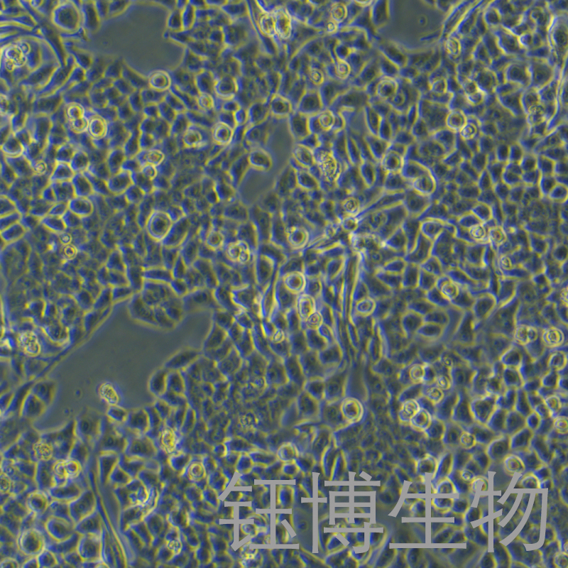 PIG1（正常人皮肤黑色素细胞）YB-75857HC