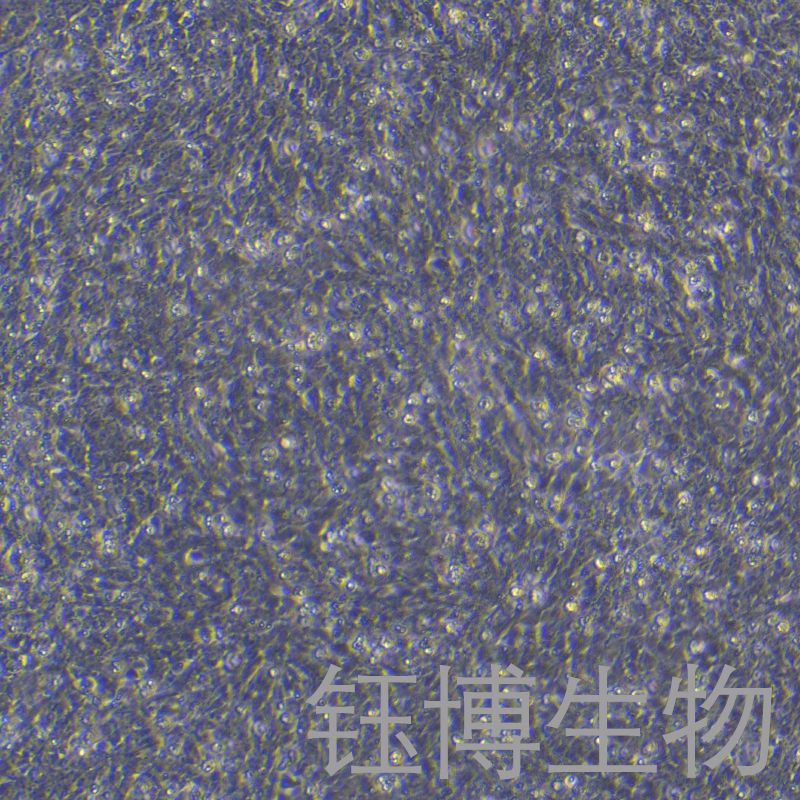 R28（大鼠视网膜前体细胞）YB-75862RC