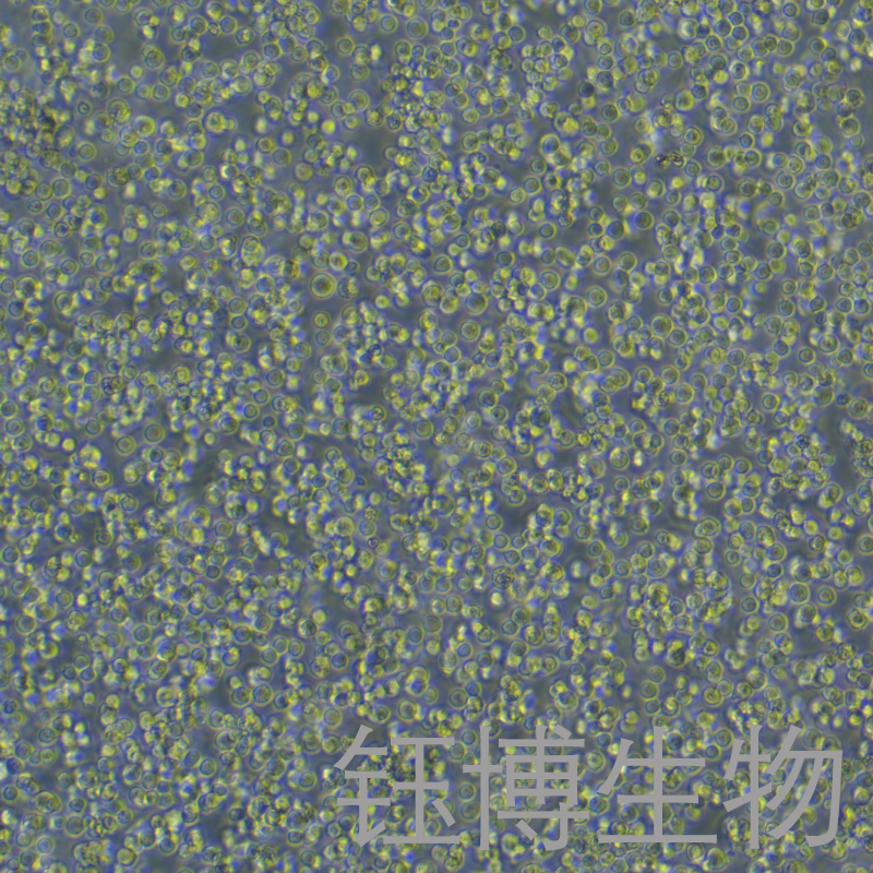 Raji-eGFP-luc（人口腔鳞癌细胞-荧光素酶标记+绿色荧光蛋白）YB-71189HC-LG