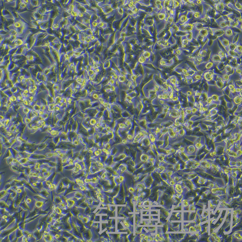 RM-1/LUC（小鼠前列腺癌细胞带荧光素酶）YB-72198MC-L