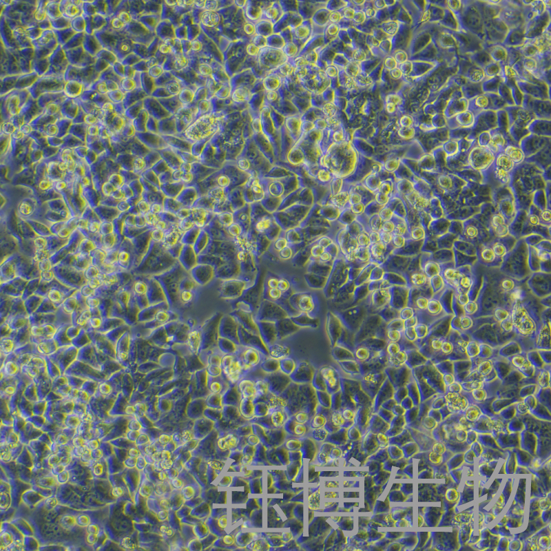 SK-BR-3-LUC（人乳腺癌细胞-荧光素酶标记）YB-71211HC-L