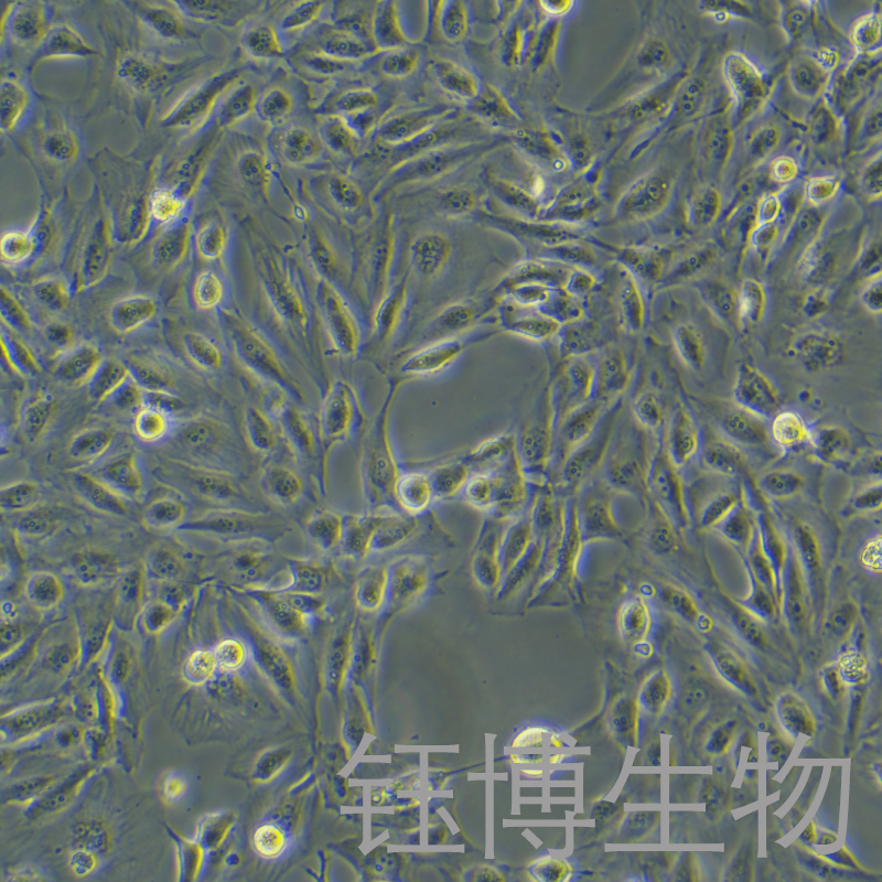 SKN（人子宫平滑肌肉瘤细胞）YB-75877HC