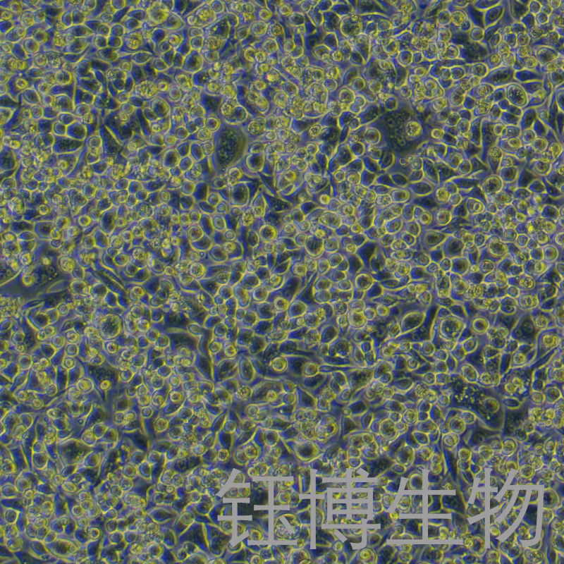 SNU601（人胃癌细胞）YB-75881HC