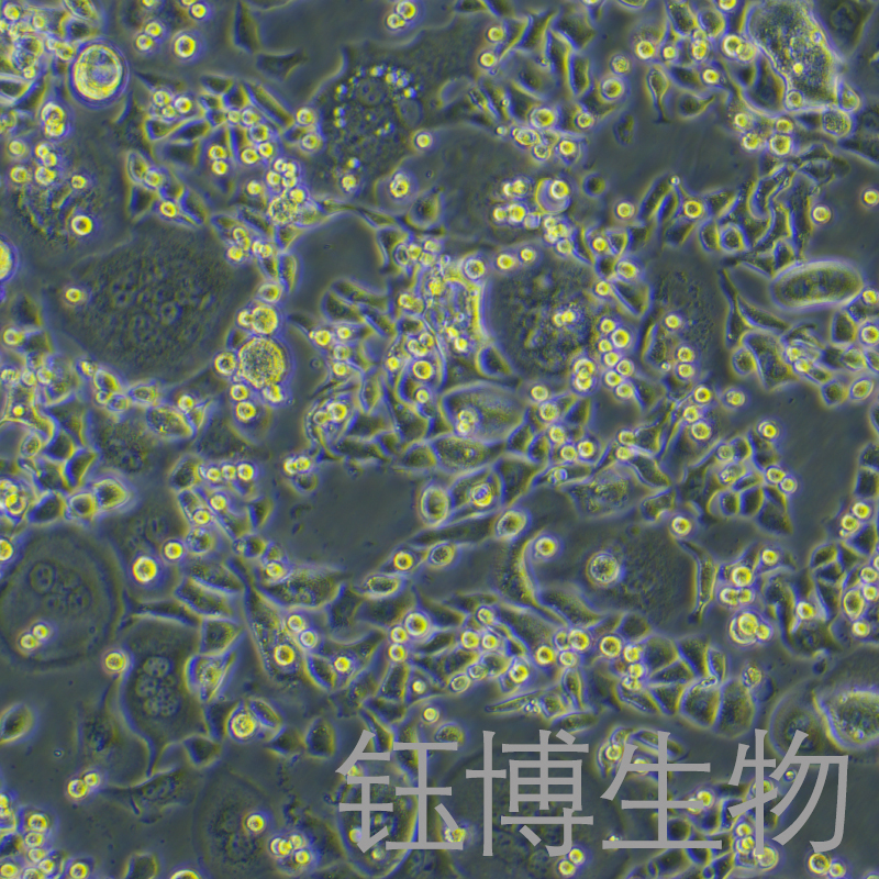 SNU-C2A（人结肠癌细胞）YB-75883HC