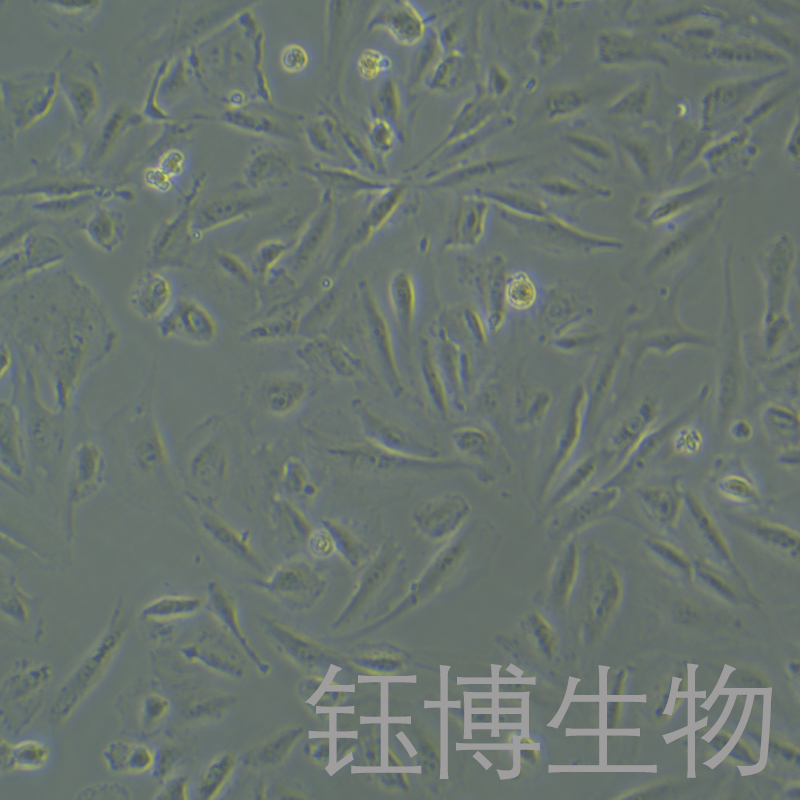 SSP-25（人肝胆管癌细胞）YB-75885HC