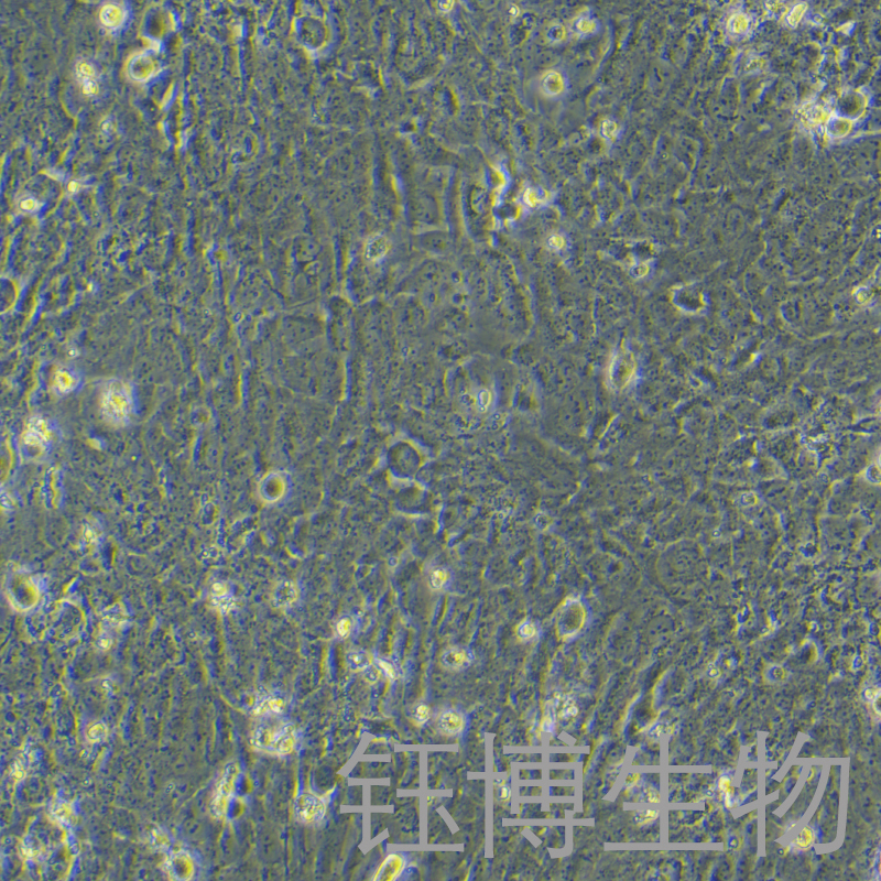 SVGP12（人星形胶质细胞）YB-75889HC