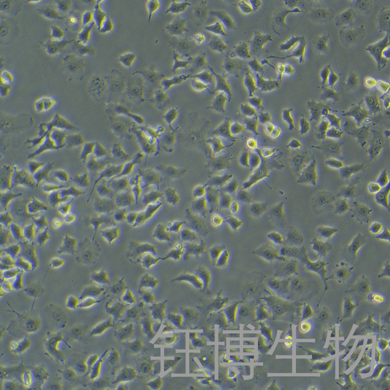 TOV21G（人卵巢癌细胞）YB-75896HC