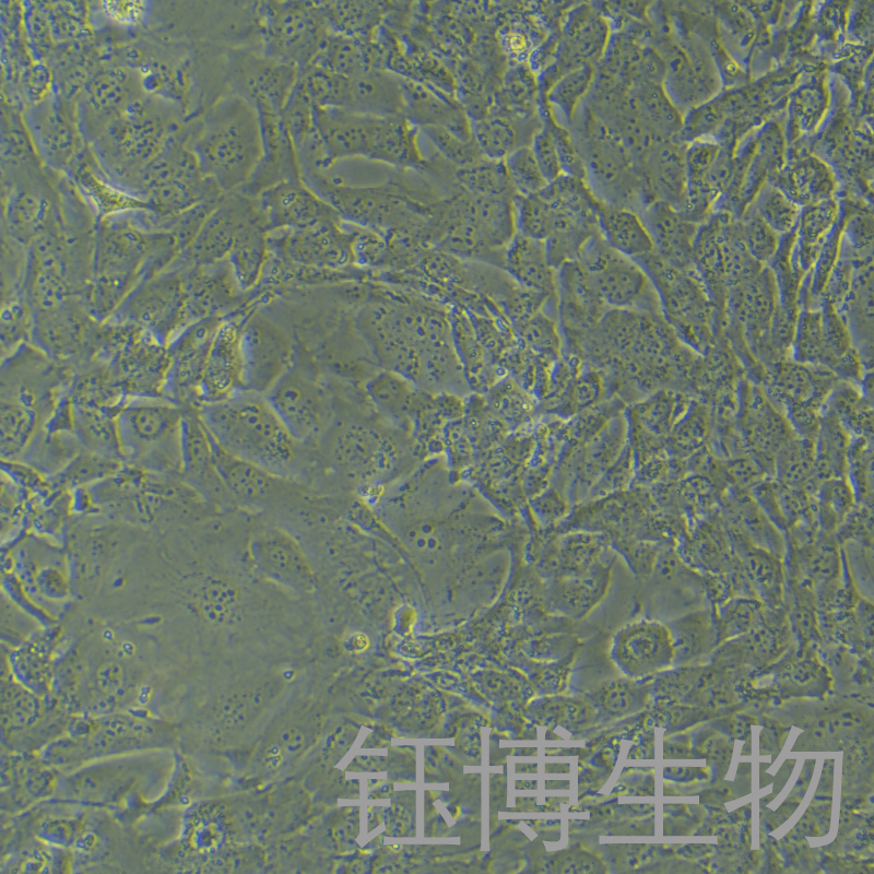 Tramp-C1（小鼠前列腺癌上皮细胞）YB-75897MC