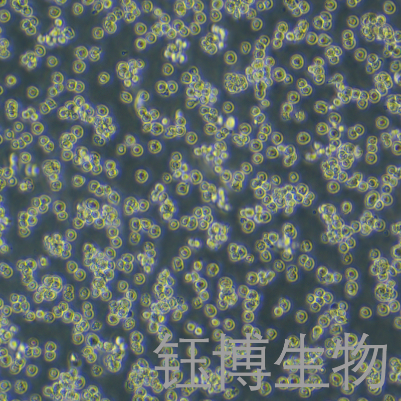 U-2932-GFP（人B淋巴细胞（GFP标记））YB-75900HC-G