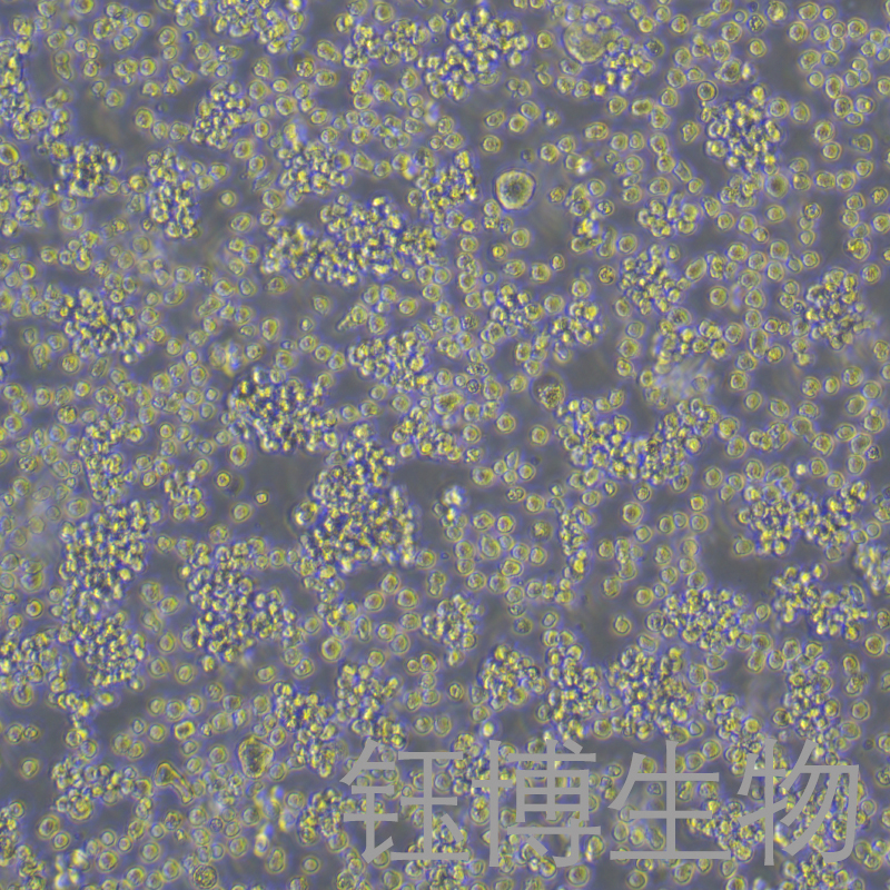 U-2932（人B淋巴细胞）YB-75902HC