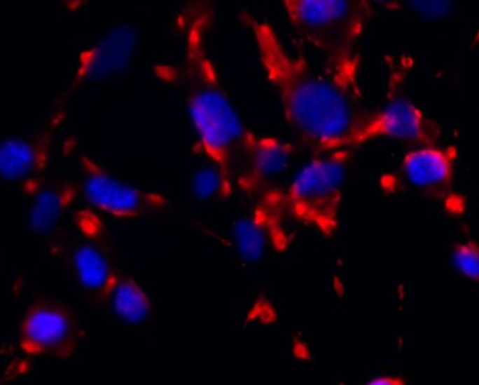 NCI-H838 人非小细胞肺癌细胞