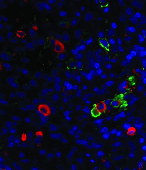 MDBK [NBL-1] 牛肾细胞