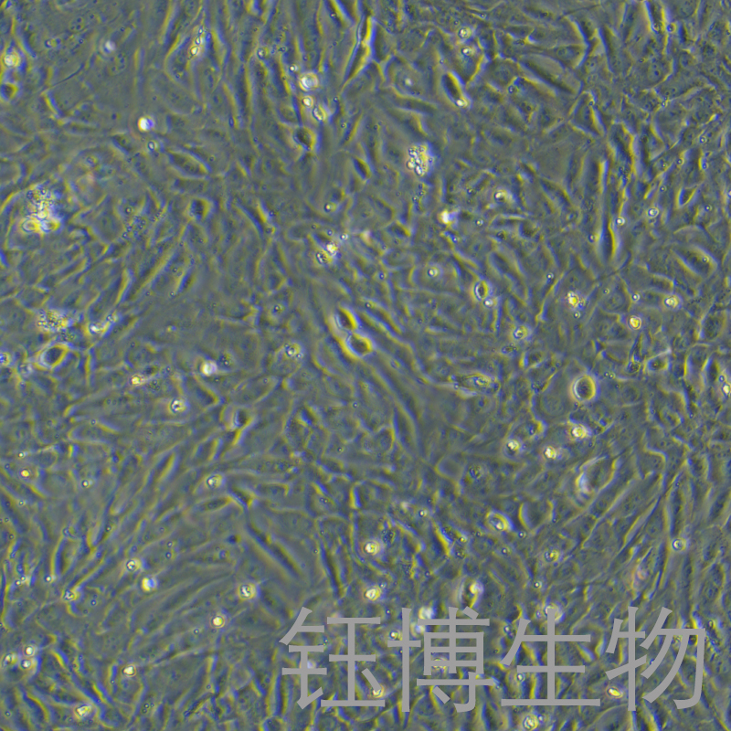 人Ⅱ型肺泡上皮细胞永生化 YB-7178HIC