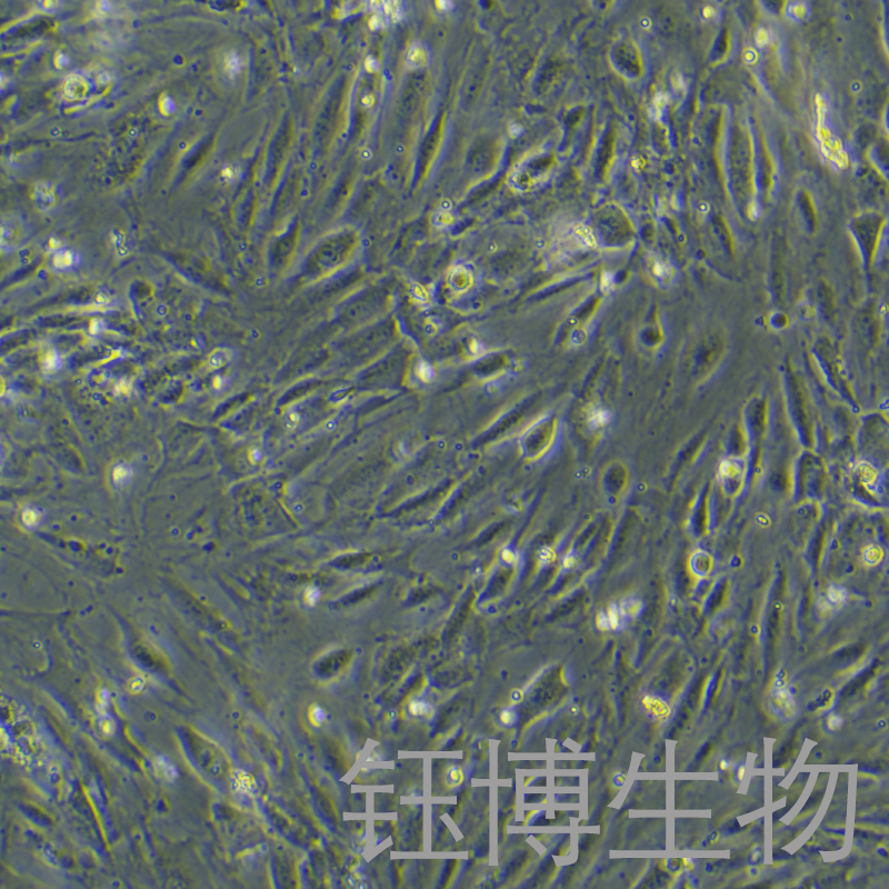 人肺微血管内皮细胞永生化 YB-7001HIC