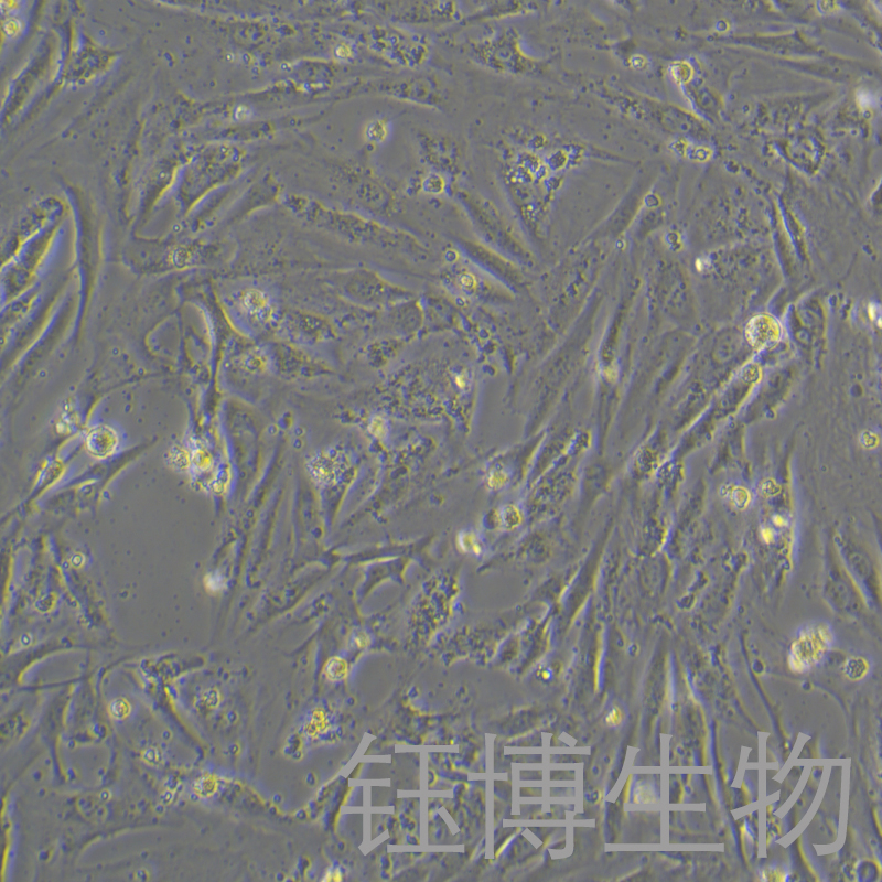 人风湿性关节滑膜成纤维细胞永生化 YB-75923HIC