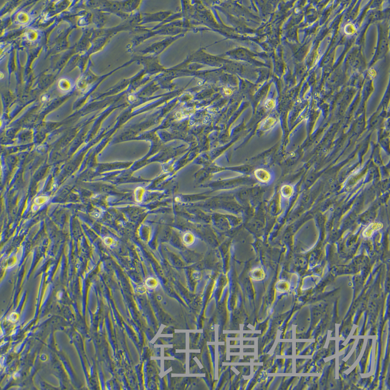 人肝成纤维细胞永生化/人正常肝成纤维细胞永生化 YB-75925HIC