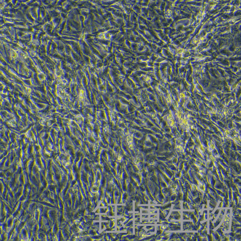 人甲状旁腺细胞永生化 YB-75926HIC