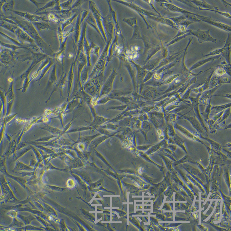 人软骨细胞永生化 YB-7093HIC