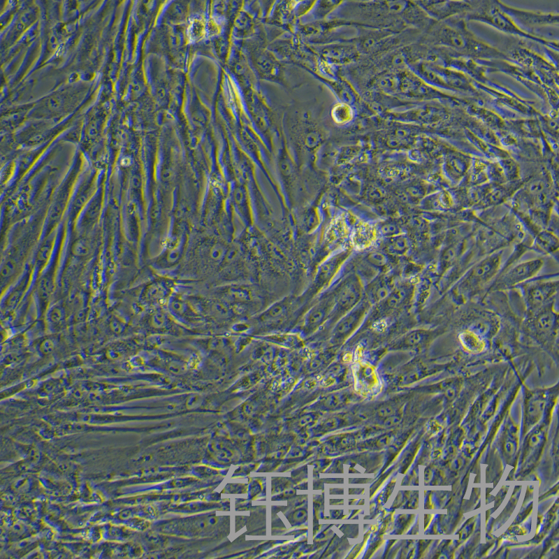 人主动脉瓣膜间质细胞永生化 YB-75937HIC