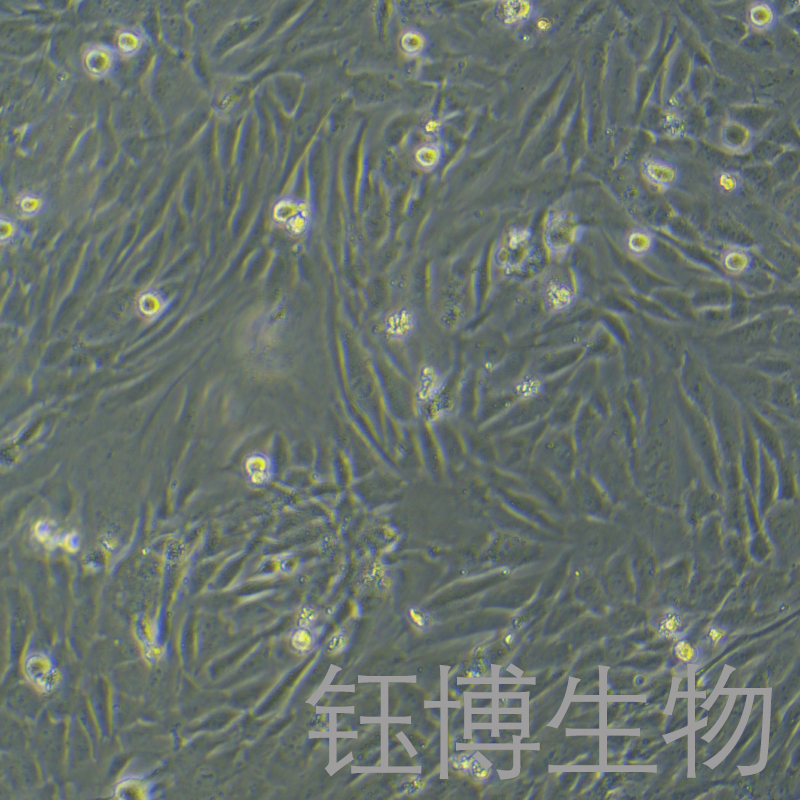 人支气管平滑肌细胞永生化 YB-7011HIC