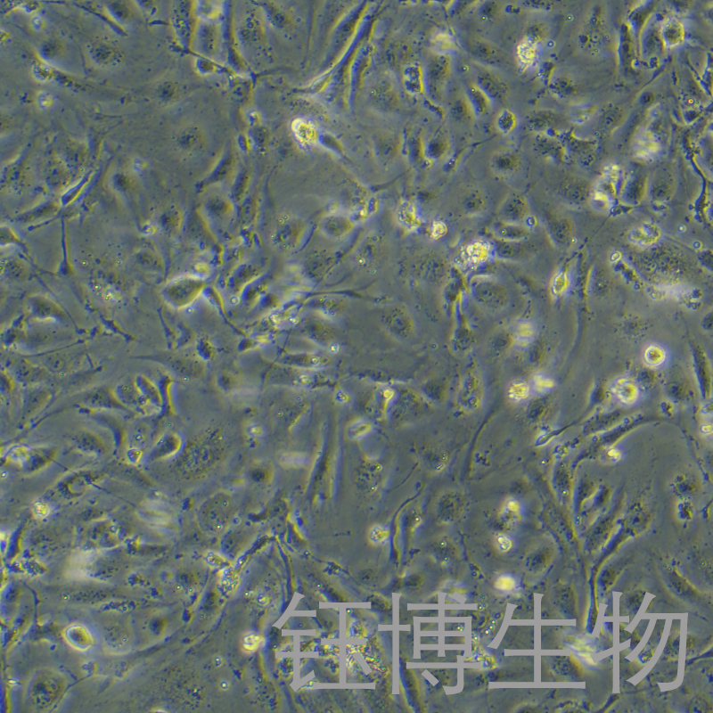 人主动脉内皮细胞永生化 YB-7072HIC
