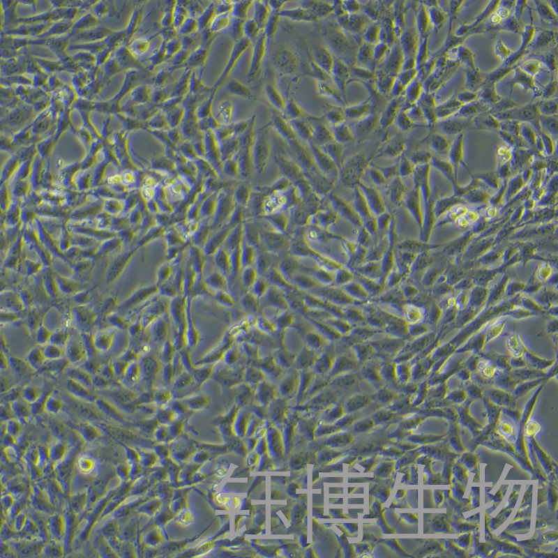 小鼠肺动脉内皮永生化细胞 YB-75941MIC