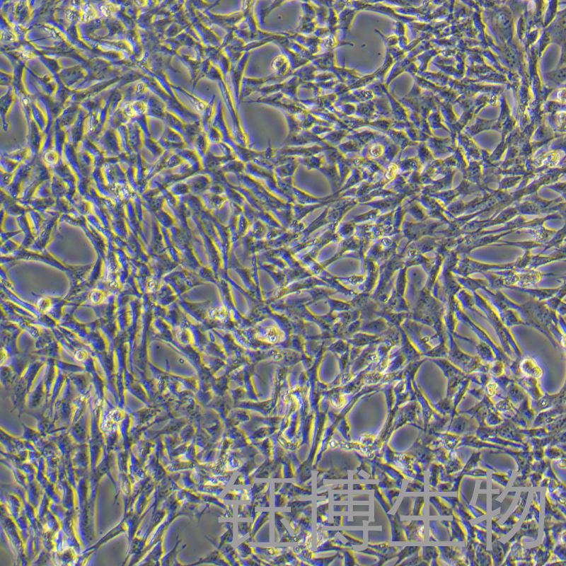 小鼠胰腺星状细胞永生化 YB-7015MIC