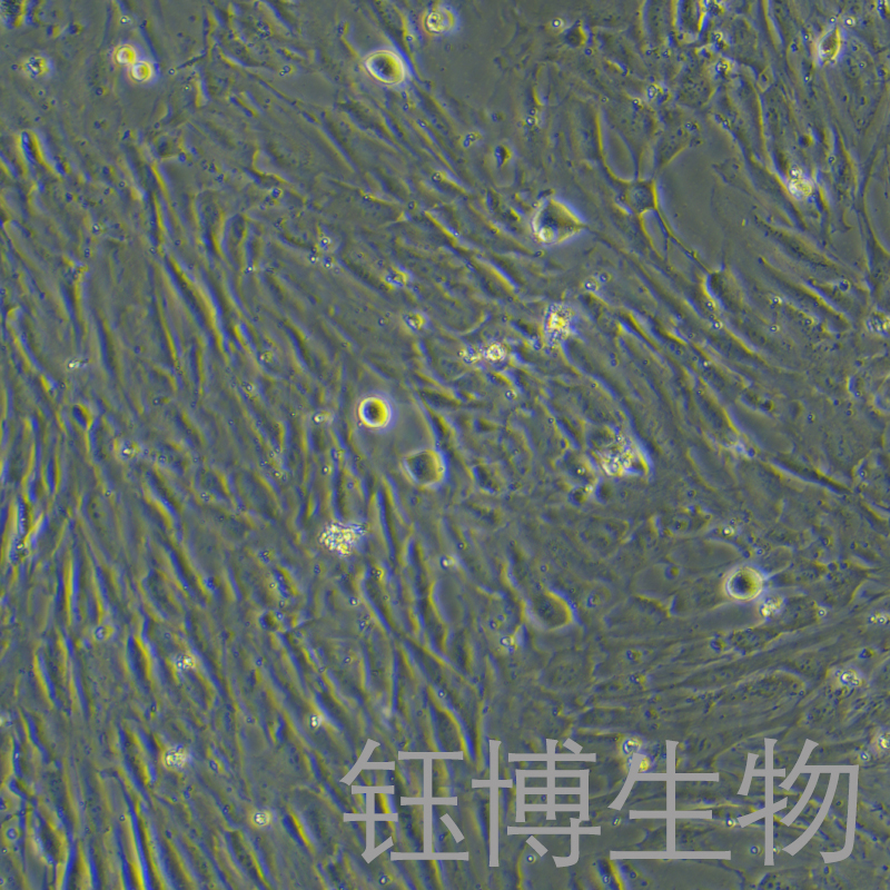 人脉络丛上皮细胞永生化 YB-7055HIC