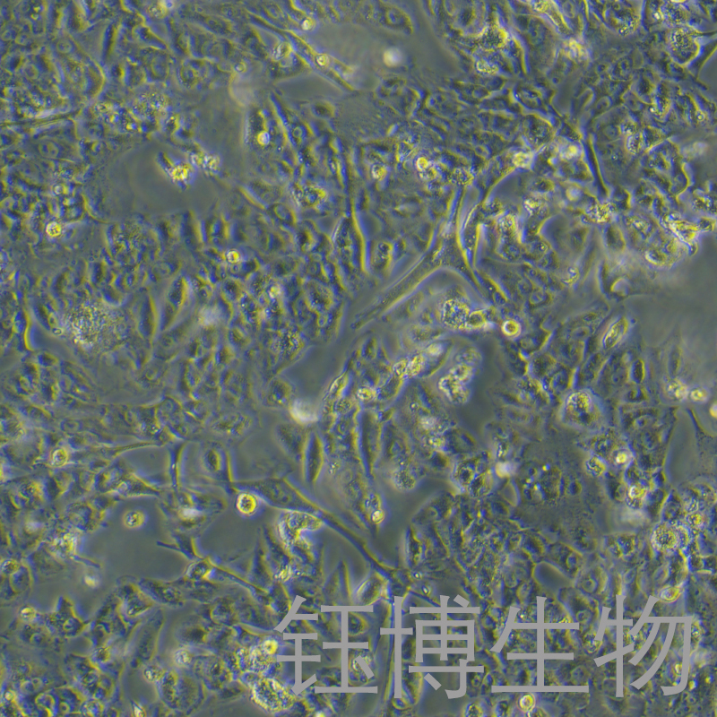 VMRC-RCW（肾细胞癌）YB-75961HC