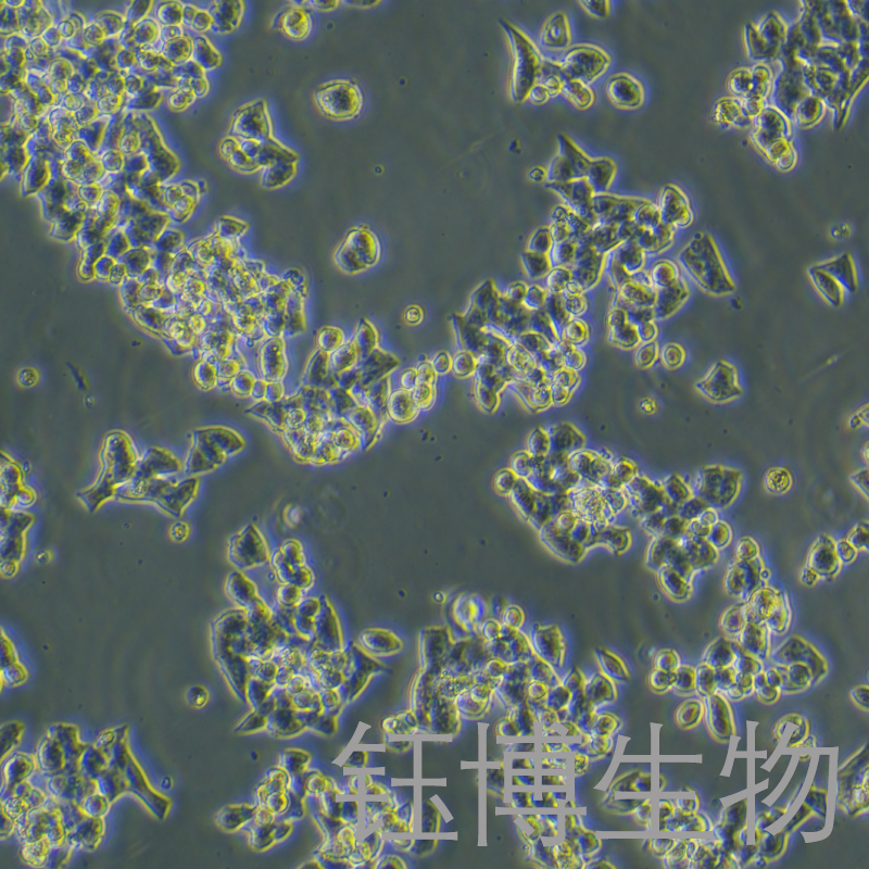 VMRC-LCD（人非小细胞肺癌细胞）YB-75960HC