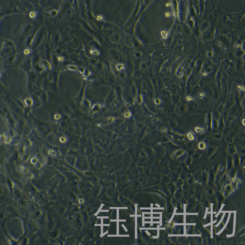 WT 9-7（人常染色体多囊肾病上皮细胞）YB-75958HC