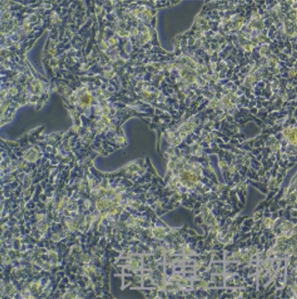 HepaRG（人肝癌细胞）YB-75969HC