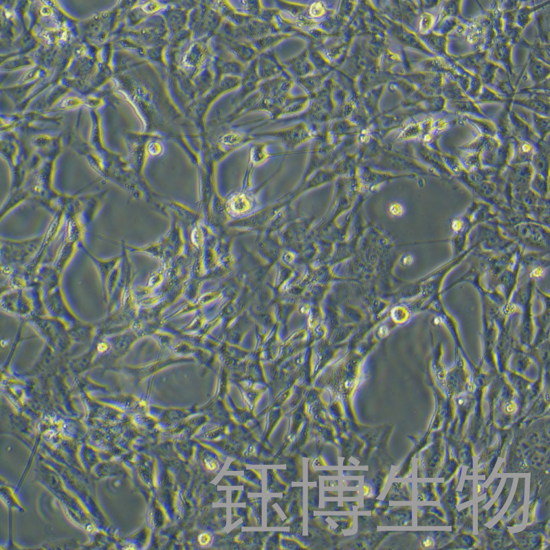 Tramp-C1-LUC（小鼠前列腺癌上皮细胞-荧光素酶标记）YB-75897MC-L