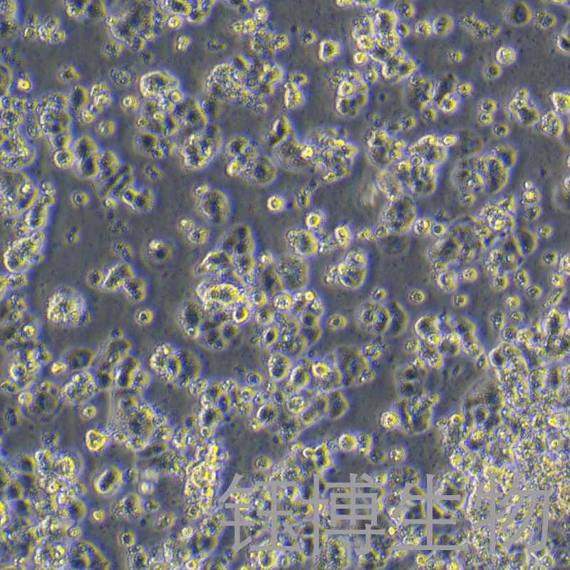 QGP-1（人胰腺癌细胞）YB-75970HC