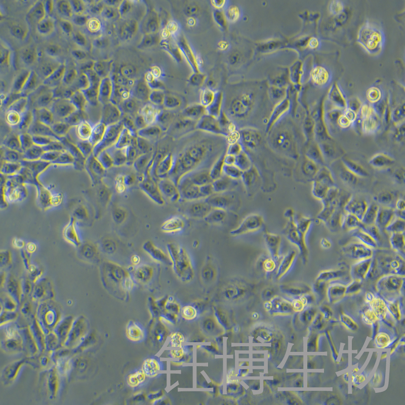 SUM149PT（人乳腺癌细胞）YB-75971HC