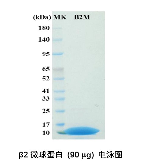 β2-微球蛋白(β2-MG B2M 重组蛋白)